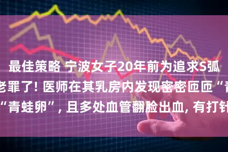 最佳策略 宁波女子20年前为追求S弧线丰胸, 如今遭老罪了! 医师在其乳房内发现密密匝匝“青蛙卵”, 且多处血管翻脸出血, 有打针史的淡薄自查就医